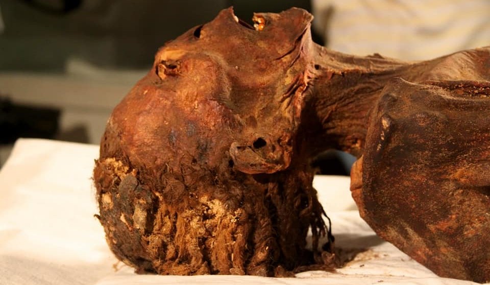 Ki segített múmia a prosztatitisből Prostatitis gyertya gyertya sajtó