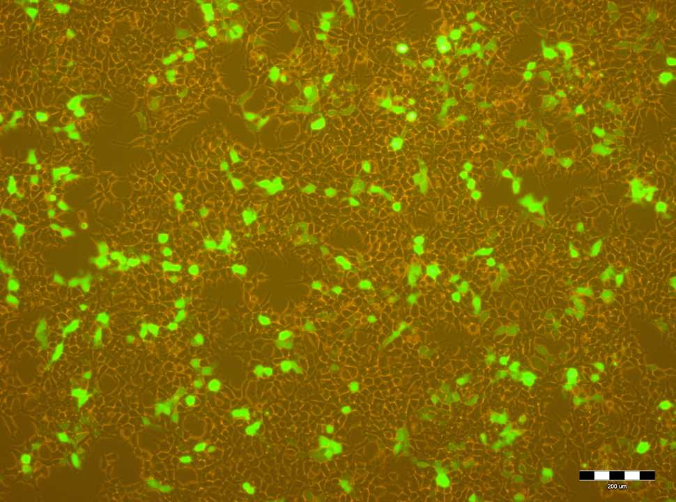 Fluoreszcencia mikroszkópos felvétel HEK-293 sejtekről, amelyek egy része egy zöld fluoreszkáló fehérjét termel (a kép a Génreguláció Kutatócsoport laboratóriumában készült)